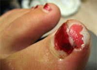 toe.jpg