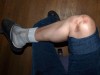 A few more bruises