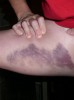 Kate\'s Thigh